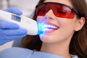 Clareamento Dental em Jundiaí - Clínica Odontológica Dental Care