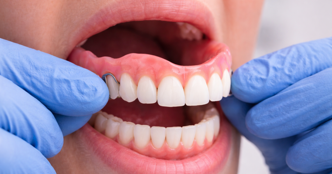 Prótese Dentária em Jundiaí - Dentista em Jundiaí - Dental Care