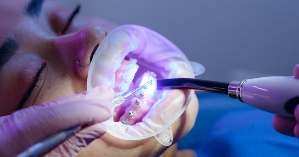 Aparelho ortodontico em jundiaí - Dentista em Jundiaí