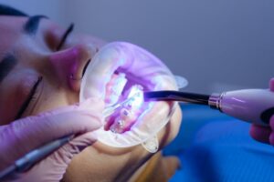 Aparelho ortodontico em jundiaí - Dentista em Jundiaí