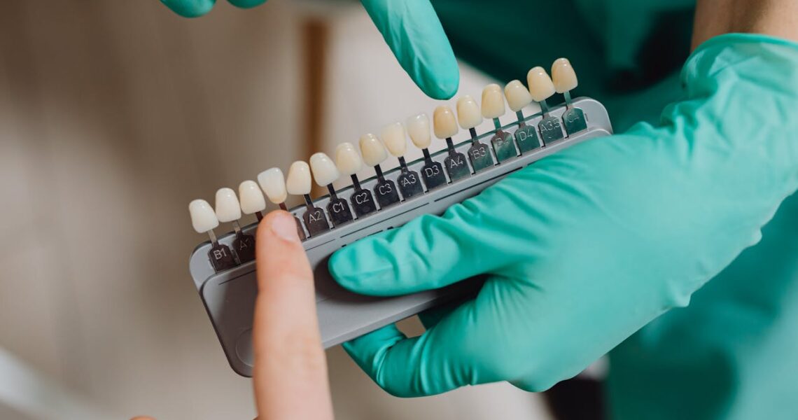 Lentes de contato Dentário em Jundiaí - Dentista em jundiaí