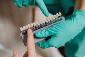 Lentes de contato Dentário em Jundiaí - Dentista em jundiaí